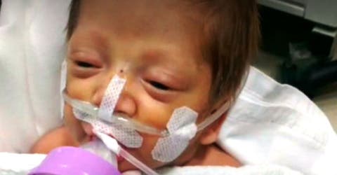 Así salvaron al bebé que estuvo 2 meses en el vientre de su madre con muerte cerebral