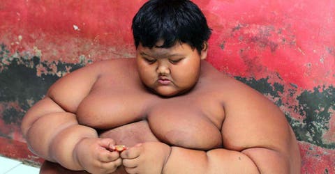 El niño más gordo del mundo pierde una sexta parte de su peso tras una cirugía que salvó su vida