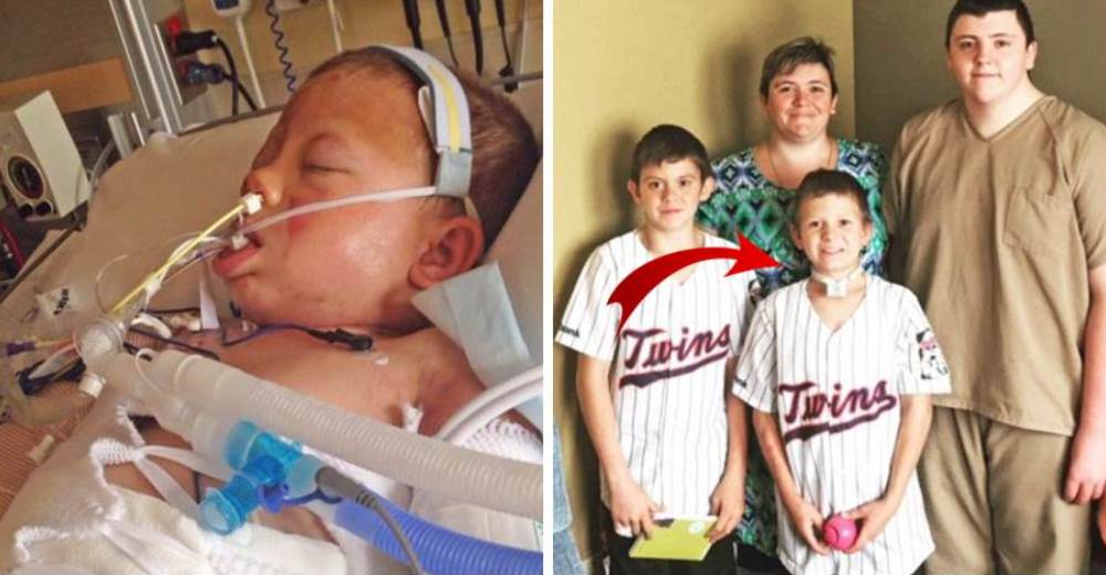 Un niño de 11 años se recupera milagrosamente de las terribles quemaduras que cubrían su cuerpo Un niño de 11 años se recupera milagrosamente de las terribles quemaduras que cubrían su cuerpo