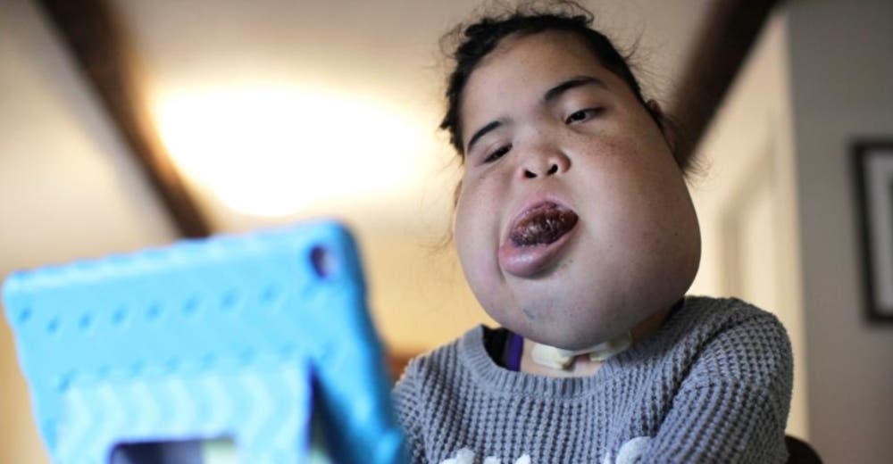 Vence todos los pronósticos aunque los médicos dijeron que no sobreviviría ni un año