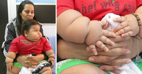 Santiago, el niño de 8 meses que pesa 20 kilos y lucha contra una extraña enfermedad