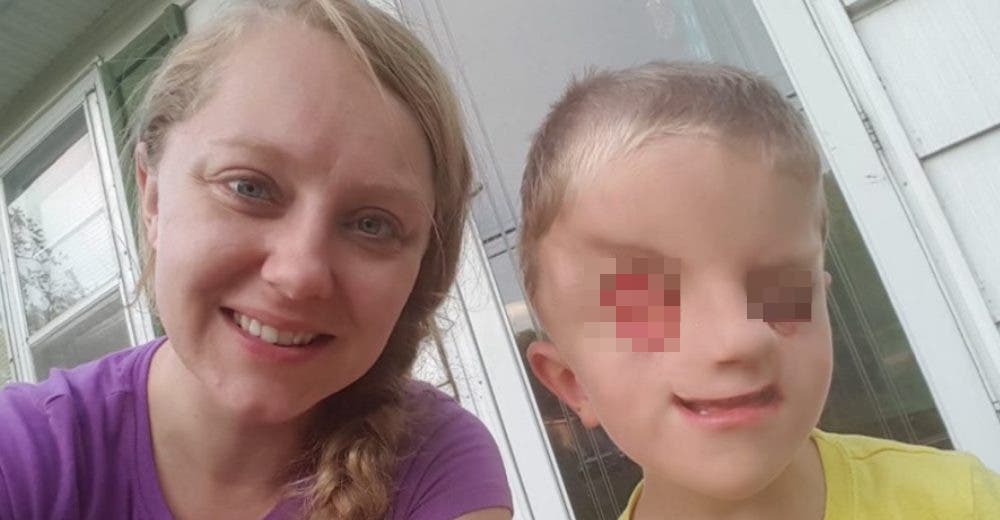 La impresionante historia de Christian Buchanan, el niño que nació sin ojos La impresionante historia de Christian Buchanan, el niño que nació sin ojos