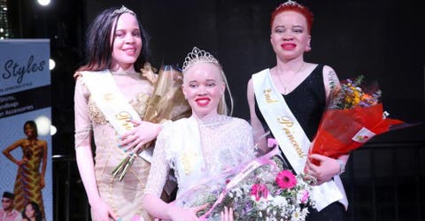 En una lucha contra el racismo, Zimbabue celebra el primer concurso «Miss Albina»