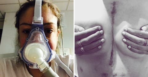 Ella cuenta cómo se siente vivir con doble trasplante de pulmón a los 27 años