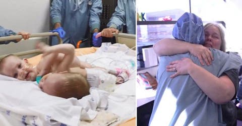 Jill Richards madre gemelas conjuntas ana grace hope elizabeth separadas Dr. Oluyinka Olutoye, Texas Children’s Hospital,