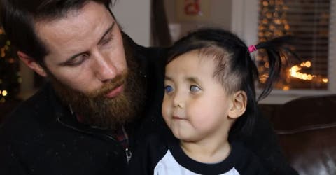 Adoptan a la niña de ojos plateados que fue abandonada por su condición