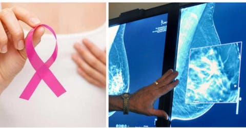 Un revolucionario tratamiento elimina por completo el cáncer de una mujer con metástasis