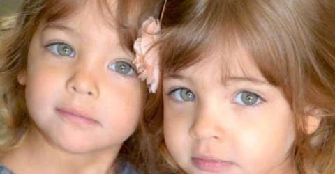Las últimas fotos de las “gemelas más bellas del mundo” impresionan a sus seguidores