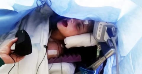 Una adolescente sorprende a todos cantando mientras es sometida a una cirugía cerebral