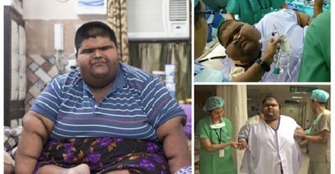 El adolescente más pesado del mundo pierde 100 kilos tras una milagrosa operación