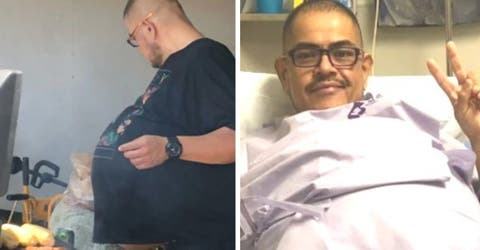 Se burlaron de su barriga durante años sin sospechar que tenía un tumor de 35 Kg