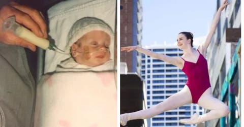 Nace con 5 agujeros en su corazón y desafía los pronósticos de vida a través del ballet