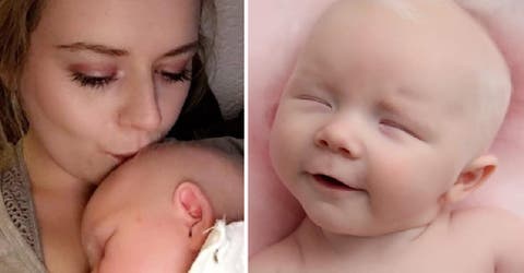 Da a luz a una bebé albina después de que los médicos le dijeran que era estéril