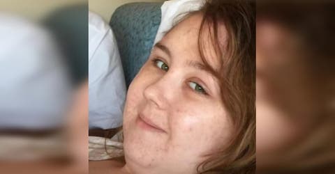 Su pareja la abandona porque cambió su apariencia mientras lucha contra el cáncer
