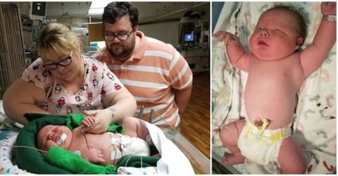 Un bebé rompe récord con su talla y peso sorprendiendo a todos en el quirófano