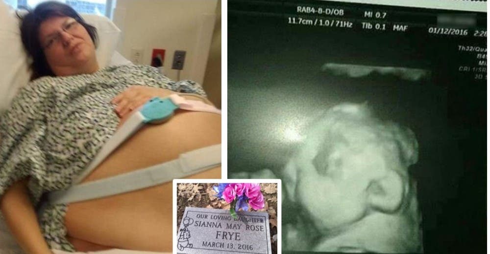 Una madre relata cómo perdió a su hija justo antes del nacimiento por una enfermedad cerebral Una madre relata cómo perdió a su hija justo antes del nacimiento por una enfermedad cerebral