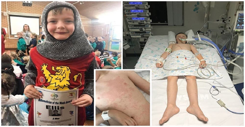 Llevan a su hijo de 6 años al hospital y acaba en coma con pocas esperanzas de sobrevivir Llevan a su hijo de 6 años al hospital y acaba en coma con pocas esperanzas de sobrevivir