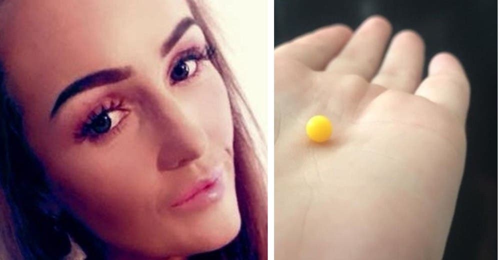 Tras 11 años perdiendo progresivamente su audición descubre un objeto alojado en su oído Tras 11 años perdiendo progresivamente su audición descubre un objeto alojado en su oído