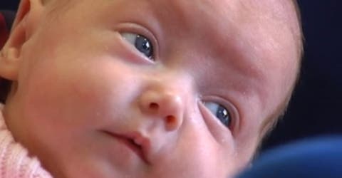 Se convierte en la bebé más pequeña del mundo en superar con éxito una compleja cirugía cardíaca