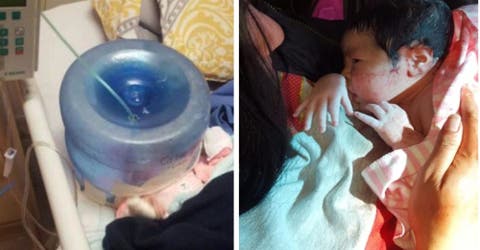 Improvisan una incubadora con una botella de agua para una bebé recién nacida en el hospital