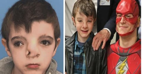 Los médicos revelan el nuevo rostro de un niño de 9 años tras una operación que cambió su vida