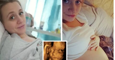 Sacan a su bebé del vientre materno para operarlo y continuar con el embarazo