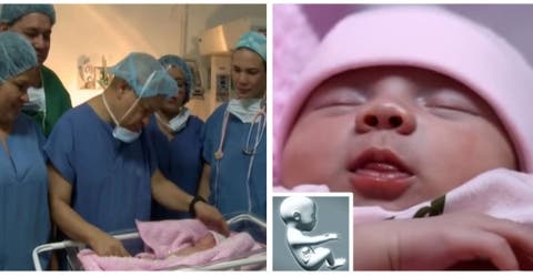 Una bebé nace “embarazada” de su hermano gemelo y causa conmoción en el mundo