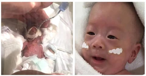 Salvan al bebé prematuro más pequeño del mundo que nació pesando 268 gramos