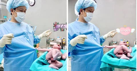 El impresionante caso del bebé que se aferra al médico segundos después de nacer