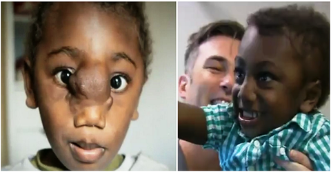Un niño de 2 años se convierte en la persona más joven en recibir una pionera cirugía facial
