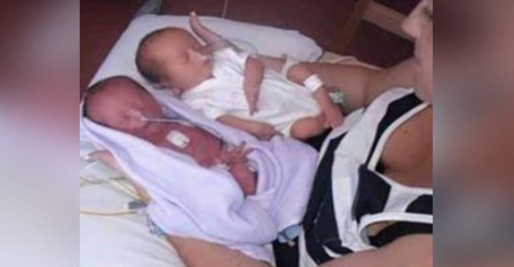Tras dar a luz a sus gemelas un médico se acerca lamentándose y le dice: «lo siento»