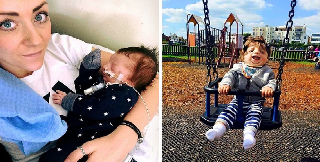 Mientras la gente señala a su bebé por la apariencia de su rostro lucha para poder operarlo Mientras la gente señala a su bebé por la apariencia de su rostro lucha para poder operarlo