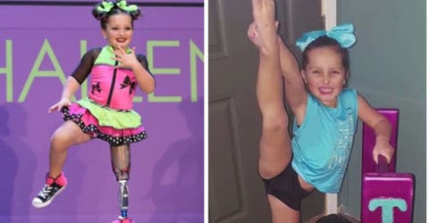 A pesar de que tuvieron que amputar su pierna no renunció a su sueño de ser bailarina