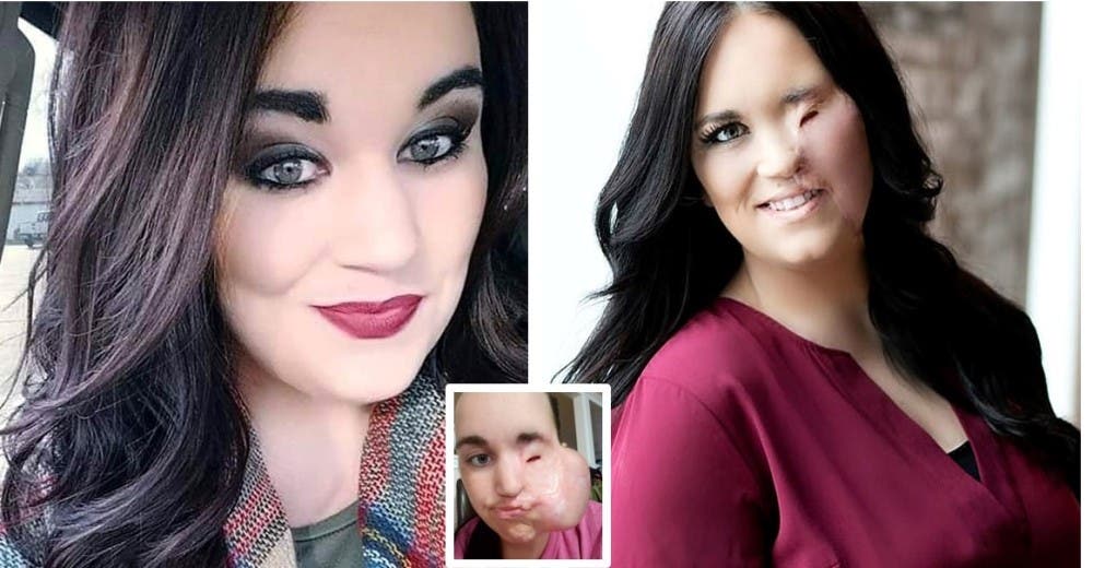 Su hija la encuentra desmayada sobre sus pinzas rizadoras con graves lesiones en su rostro Su hija la encuentra desmayada sobre sus pinzas rizadoras con graves lesiones en su rostro