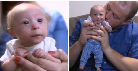 Los padres de un bebé con enanismo suplican ayuda para poder ofrecerle una vida normal