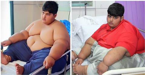Una operación podría salvar la vida del niño de 10 años que pesa más de 190 kilos