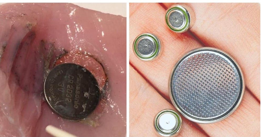 Advierten con imágenes lo que sucede pocas horas después de que un niño ingiera una batería Advierten con imágenes lo que sucede pocas horas después de que un niño ingiera una batería