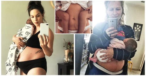 Publican fotos sin filtros de sus cuerpos tras dar a luz y luchan por aceptar sus marcas de amor