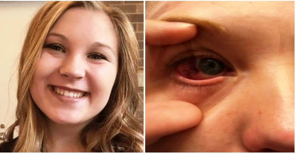 Le operan el ojo equivocado y le intervienen el otro sin anestesia para corregir el error Le operan el ojo equivocado y le intervienen el otro sin anestesia para corregir el error