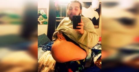 Transgénero se queja de dolor abdominal y en el hospital nadie sospechó que estaba «embarazado»
