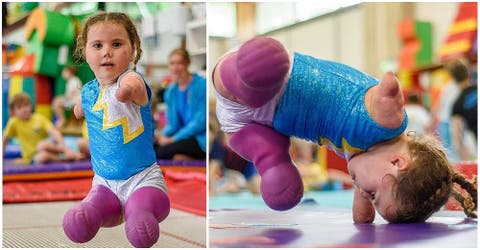 La niña de 5 años que perdió sus cuatro extremidades se convierte en una gimnasta estrella