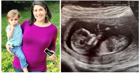 Queda embarazada de la hermana gemela de su hija 2 años después de haber dado a luz