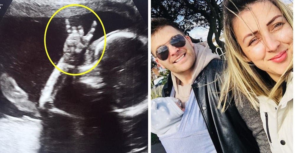 Publican la imagen de la ecografía de su bebé sin imaginar que se haría viral enseguida