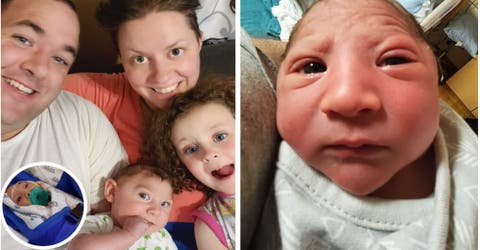 La madre de un bebé con microcefalia cuenta que su hermana «ve más allá de las imperfecciones»
