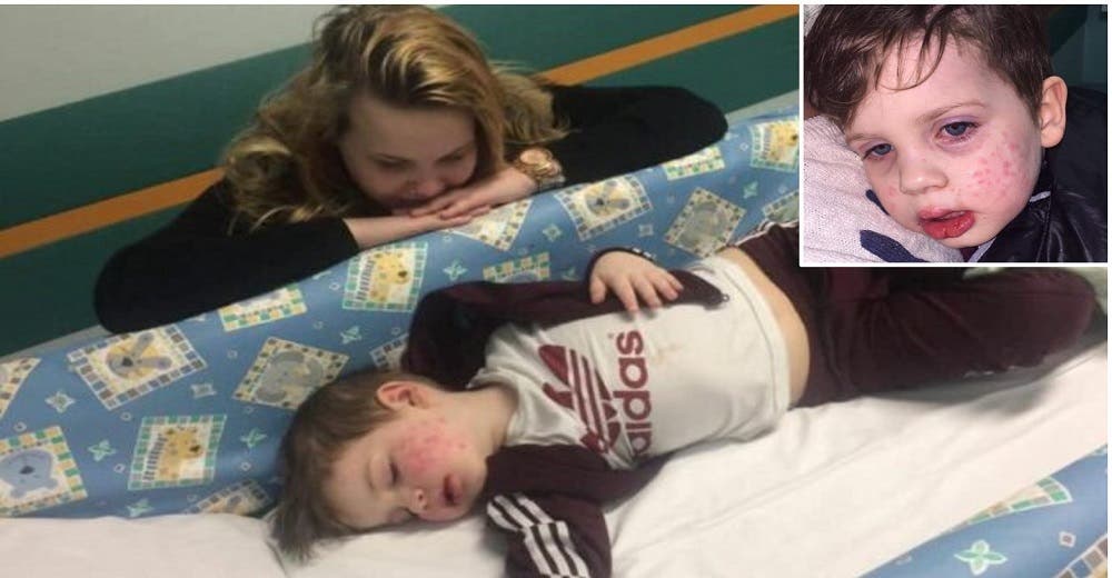 Una madre habla de su dolor después de que su pequeño de 2 años casi quedara ciego por un beso