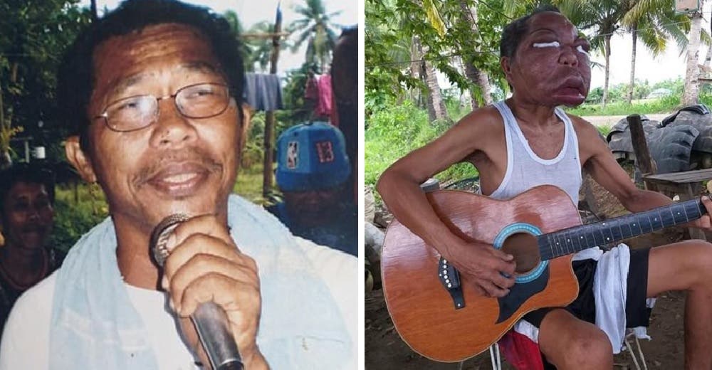 El extraño caso del hombre que no puede ver porque su cara se inflama triplicando su tamaño El extraño caso del hombre que no puede ver porque su cara se inflama triplicando su tamaño