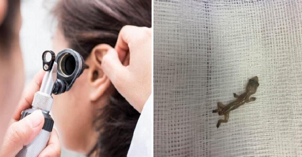 Tras quejarse por un intenso dolor encuentran a un lagarto viviendo dentro de su oído Tras quejarse por un intenso dolor encuentran a un lagarto viviendo dentro de su oído