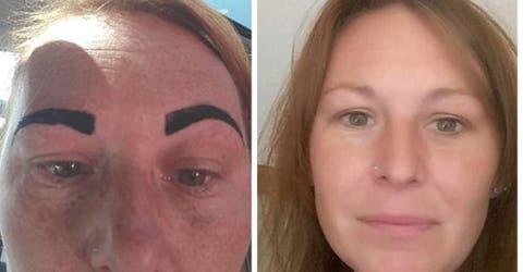 Un inadecuado tratamiento de belleza en sus cejas arruina sus vacaciones soñadas