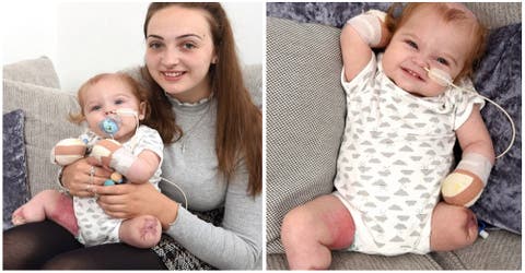 Su bebé pierde todas sus extremidades a causa de una infección- «Quiero advertir a otros padres»