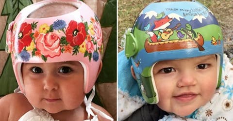 Abuela artista ayuda a bebés de rara condición que usan «casco» a atraer sonrisas y no miradas